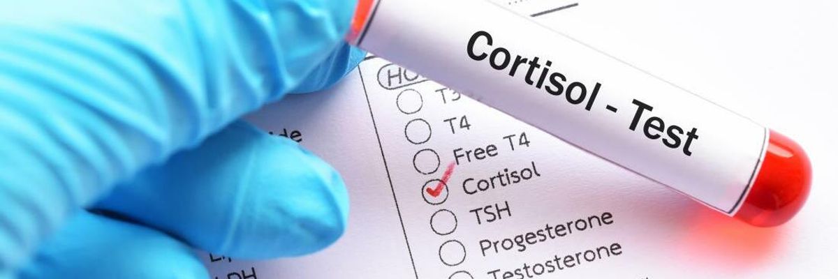 инфографика тест на кортизол