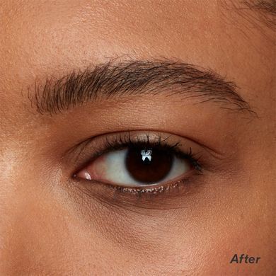 Under-eye brightening treatment for medium and dark skin tones