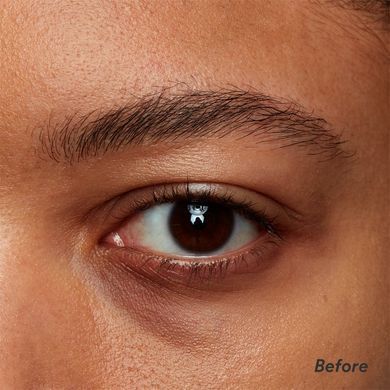 Under-eye brightening treatment for medium and dark skin tones